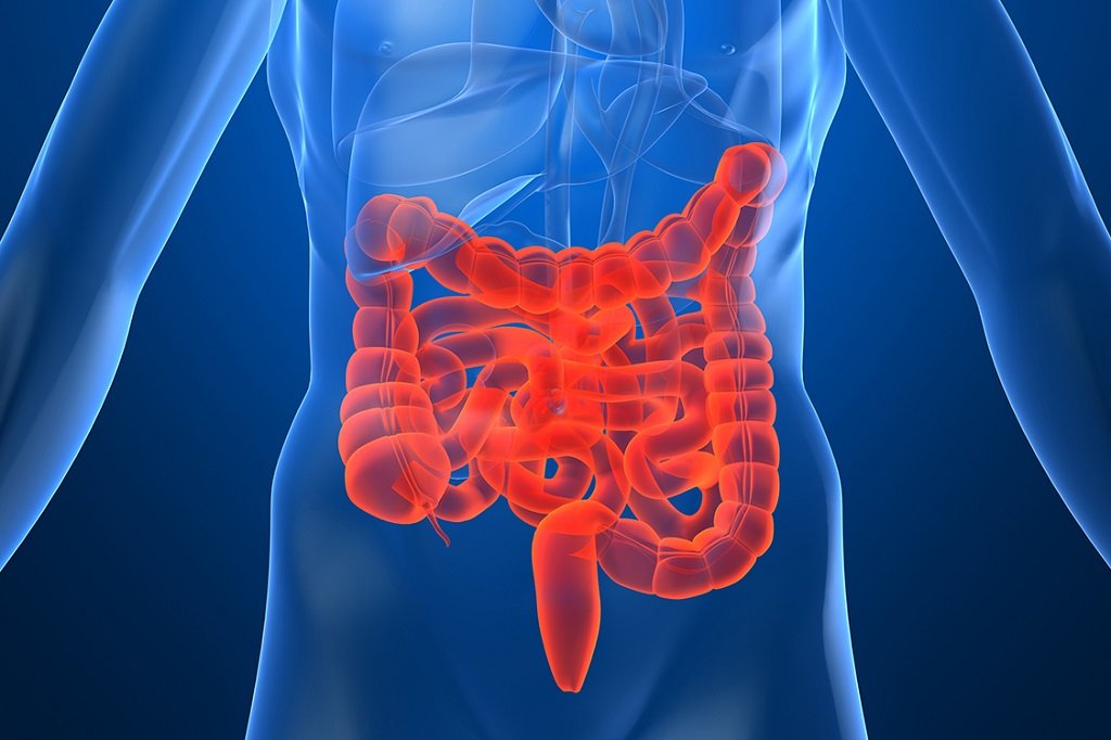 neoplasias colorretal