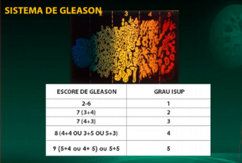Sistema de Gleason