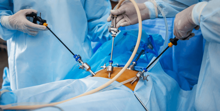cirugias minimamente invasivas em cirurgia geral