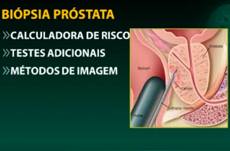 Biópsia da próstata