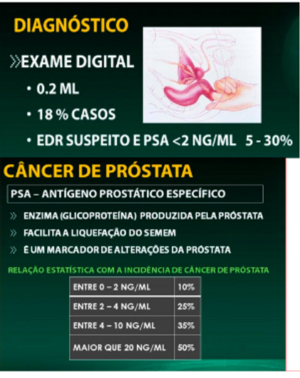 Exame para diagnóstico do câncer de próstata
