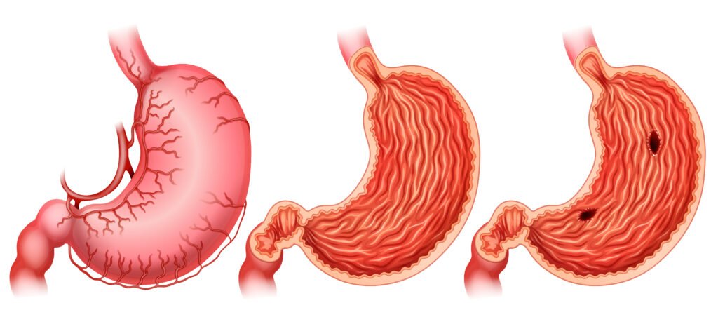 pós-graduação em gastroeterologia