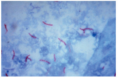 imagem de virus da tuberculose
