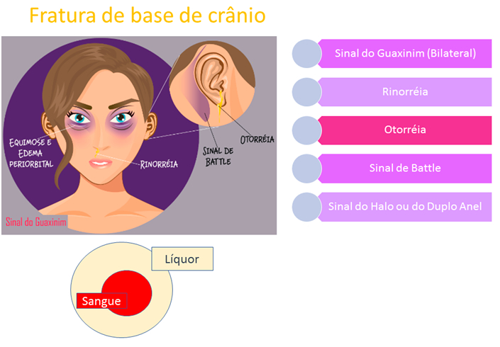fratura de base de crânio