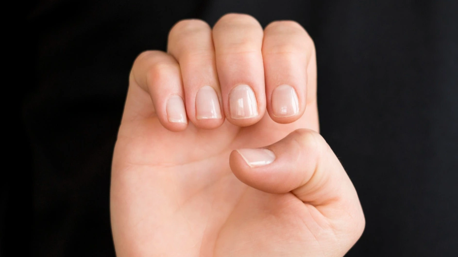 descoloração das unhas