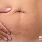 Pancreatite Aguda: confira artigo “Em destaque” do portal Medicina Atual