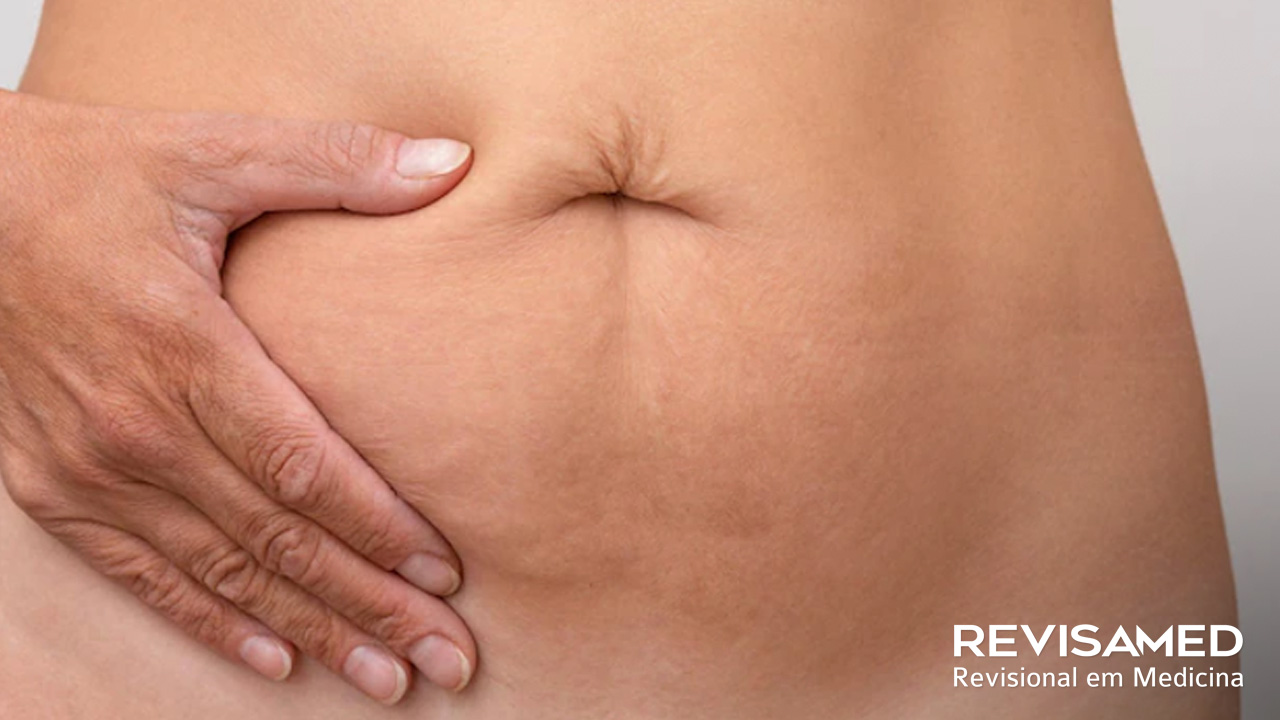 Pancreatite Aguda: confira artigo “Em destaque” do portal Medicina Atual