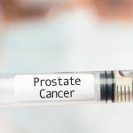 Câncer de próstata: conheça os tipos de tratamento e prognóstico